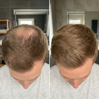 Rysmide Hair Growth Bar
