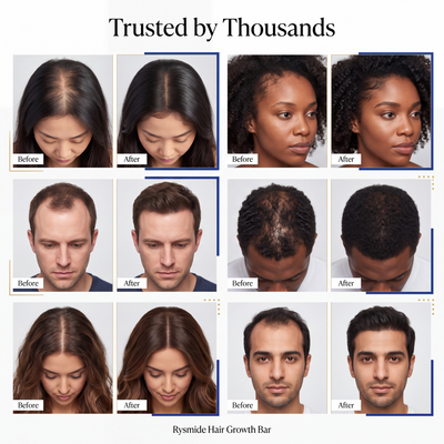 Rysmide Hair Growth Bar