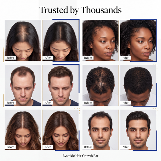 Rysmide Hair Growth Bar